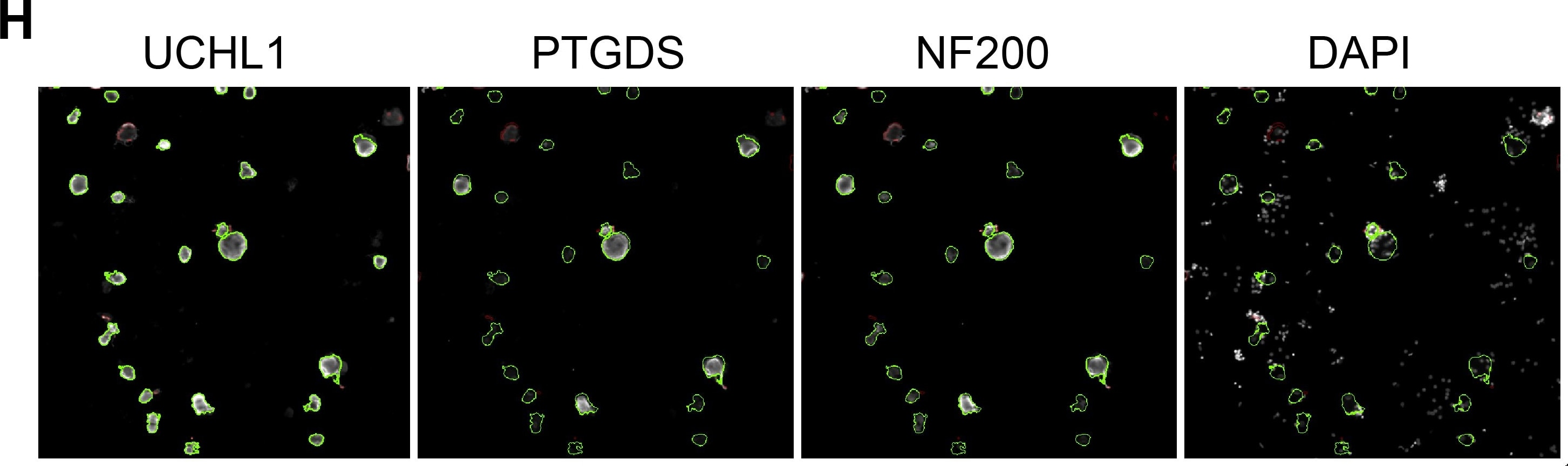 UCH-L1/PGP9.5 Antibody