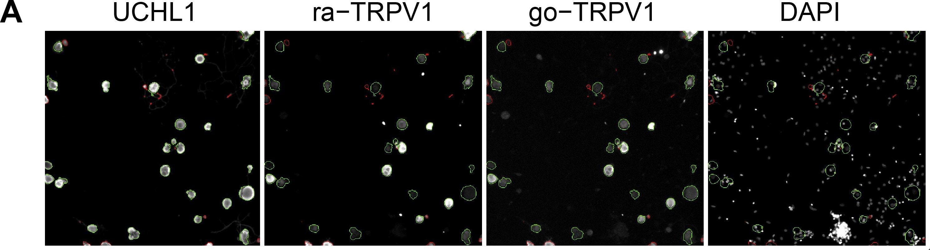 UCH-L1/PGP9.5 Antibody