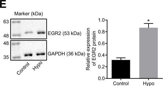 EGR2 Antibody - BSA Free