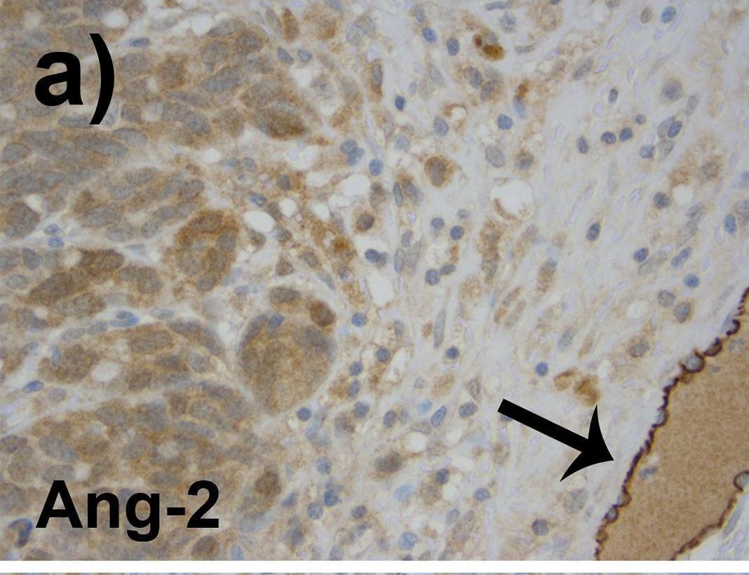 Angiopoietin-2 Antibody (MM0020-1F29) - Azide and BSA Free
