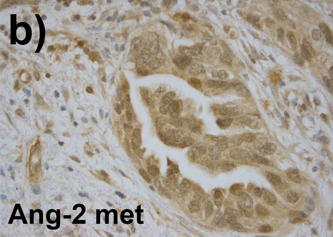 Angiopoietin-2 Antibody (MM0020-1F29) - Azide and BSA Free