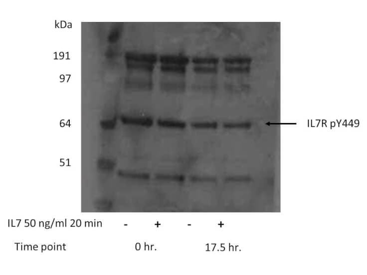 IL-7R alpha/CD127 [p Tyr449] Antibody