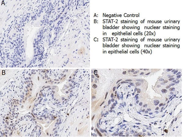 STAT2 [p Tyr690] Antibody
