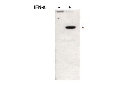 STAT2 [p Tyr690] Antibody