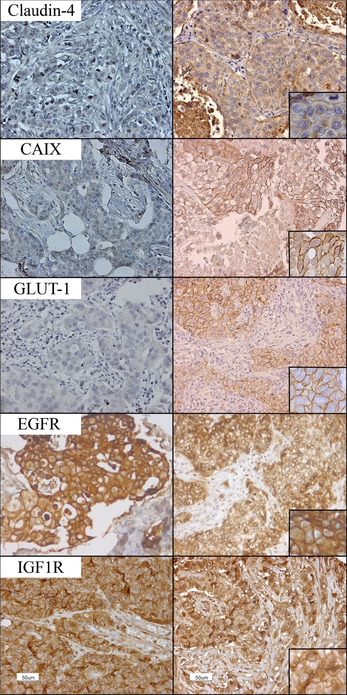 IGF-I R/IGF1R Antibody (3G5C1)
