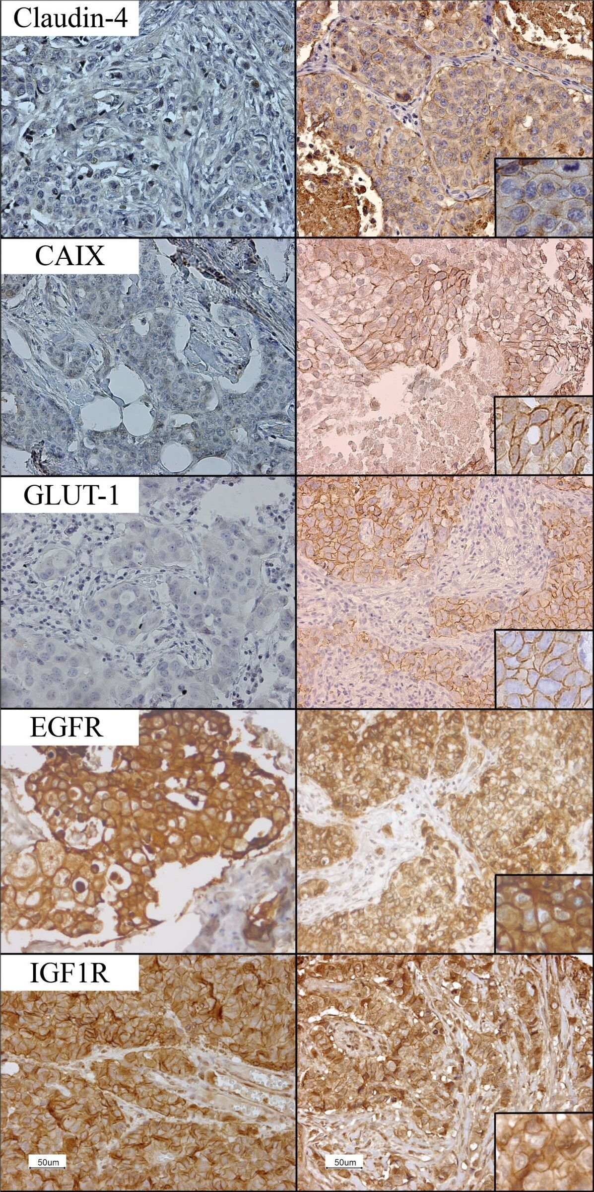 IGF-I R/IGF1R Antibody (3G5C1) - BSA Free