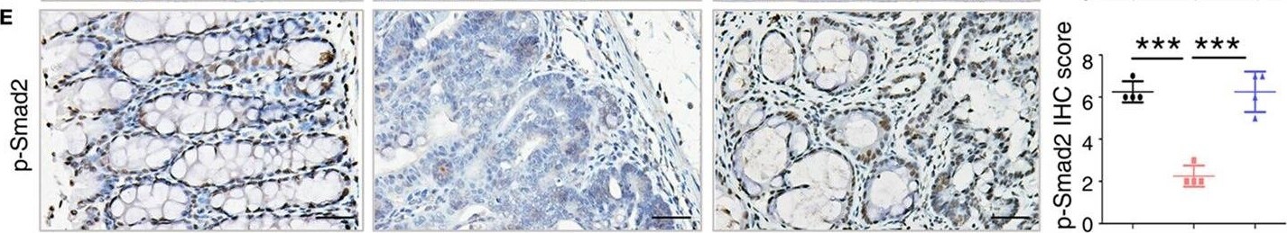 S100A9 Antibody