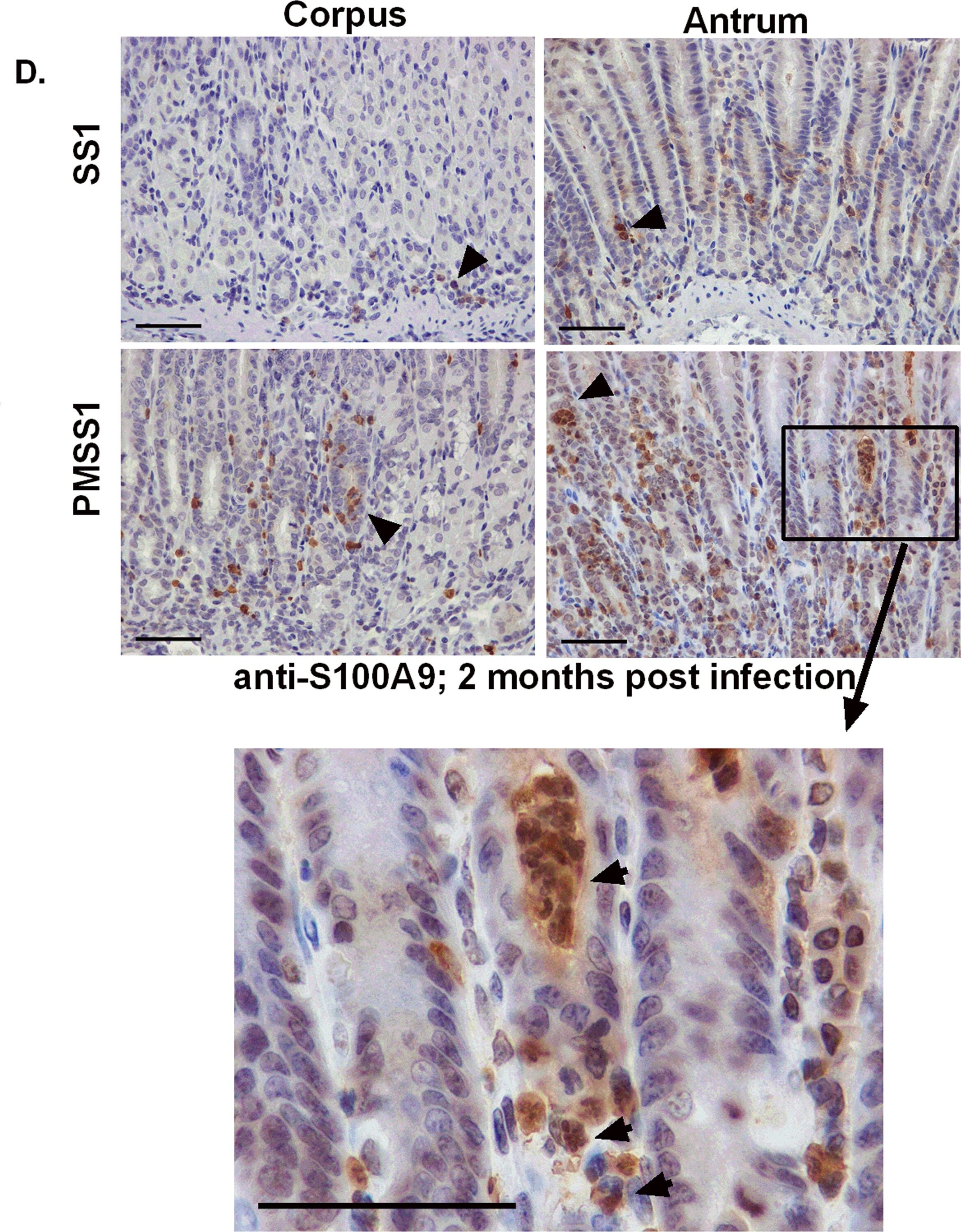 S100A9 Antibody
