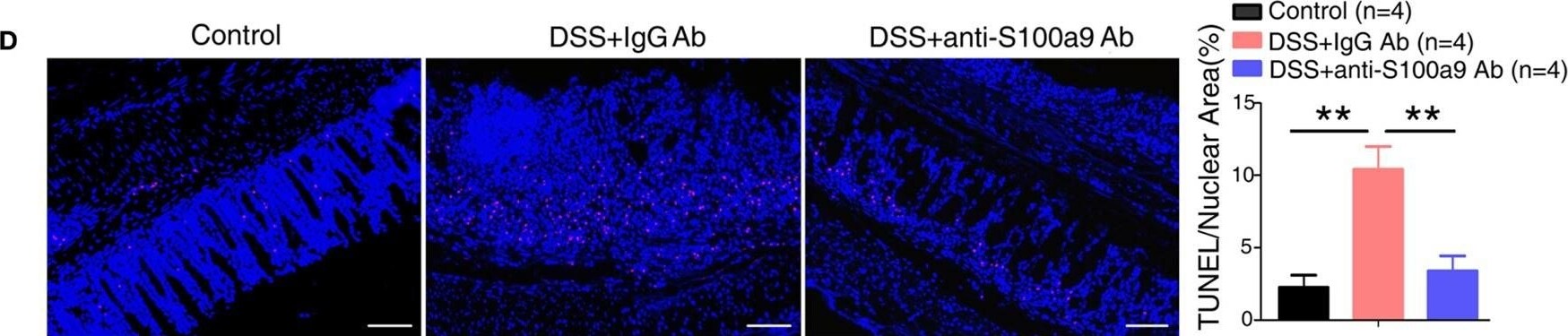S100A9 Antibody