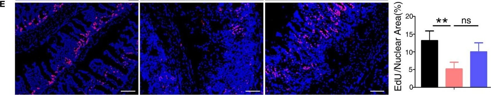 S100A9 Antibody