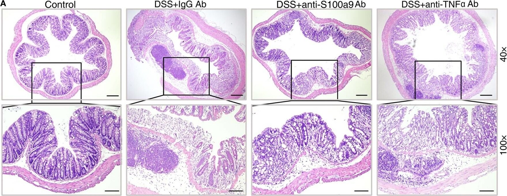 S100A9 Antibody