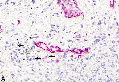 Podoplanin Antibody (LF3/B7/D5B27) - Azide and BSA Free