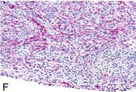 Podoplanin Antibody (LF3/B7/D5B27) - Azide and BSA Free
