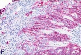Podoplanin Antibody (LF3/B7/D5B27) - Azide and BSA Free
