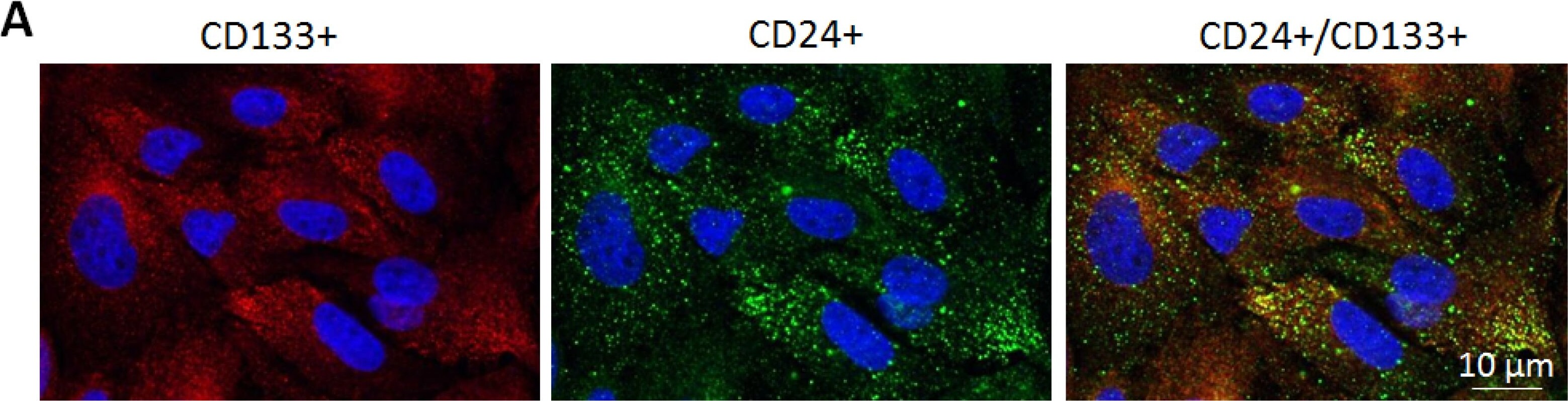CD133 Antibody [DyLight 488]