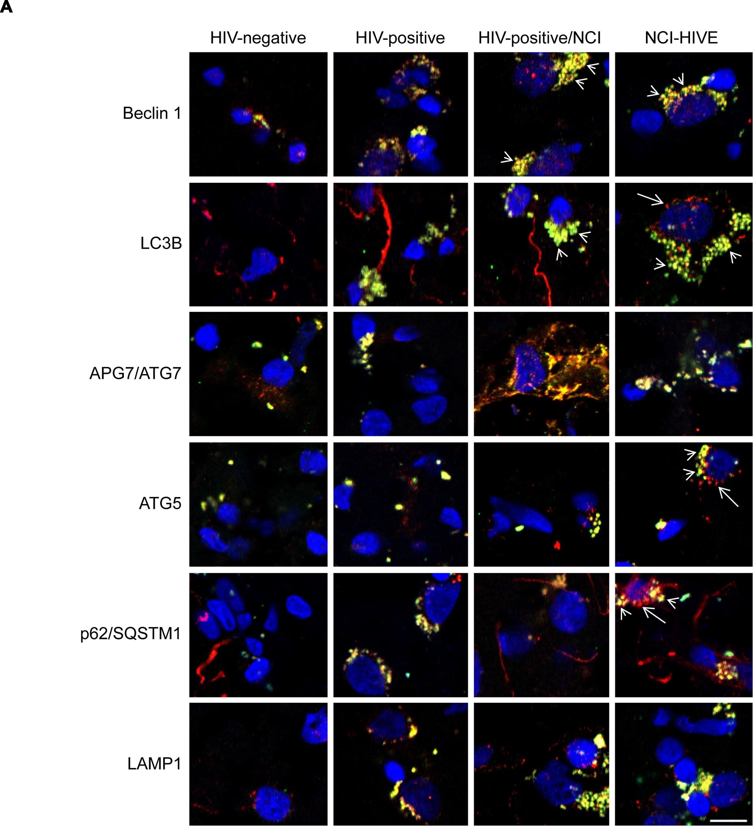 LAMP-1/CD107a Antibody