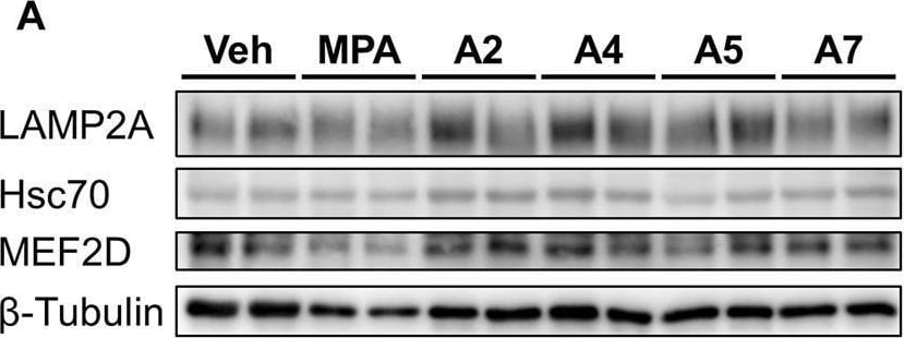 HSPA8/HSC71/Hsc70 Antibody (13D3)