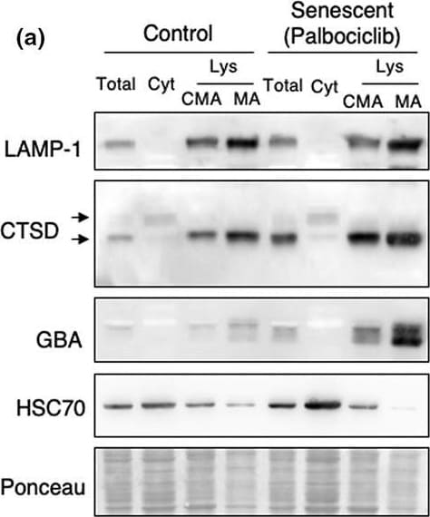 HSPA8/HSC71/Hsc70 Antibody (13D3)