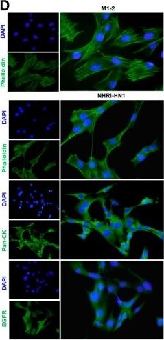 Cytokeratin, pan Antibody (PCK-26)