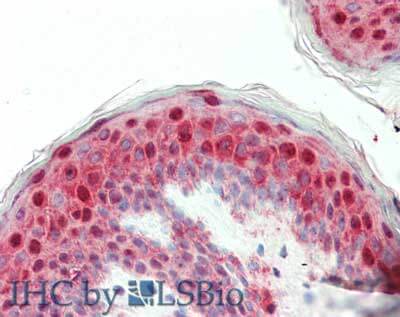 Laminin beta 1 Antibody