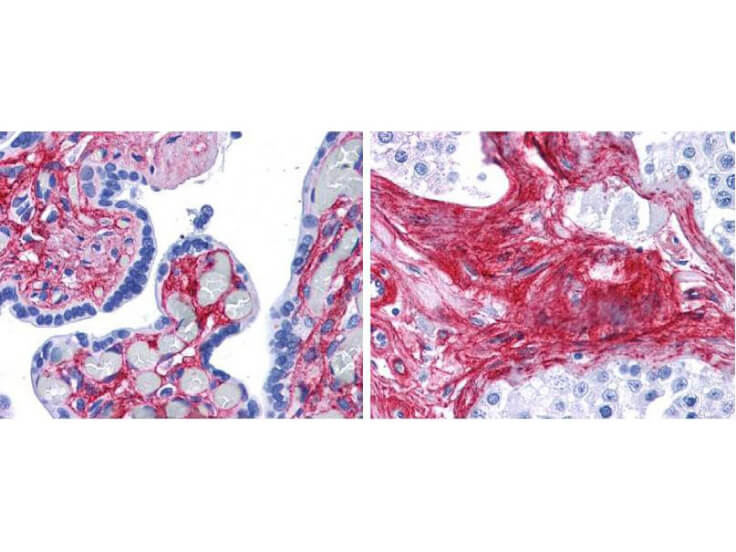 Collagen VI alpha 1 Antibody