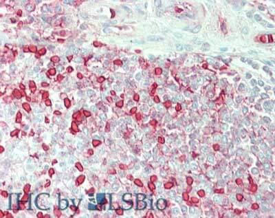 Carbonic Anhydrase I/CA1 Antibody