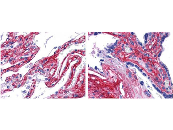 Collagen V Antibody