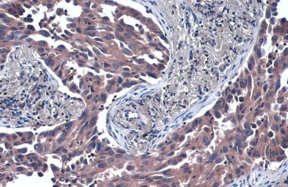 TSG101 Antibody (4A10)