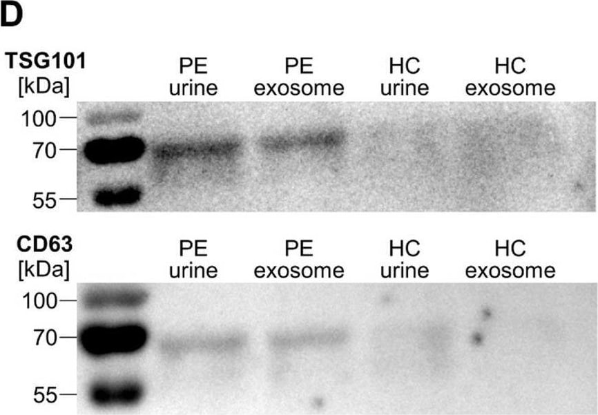 TSG101 Antibody (4A10)