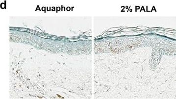 beta-Defensin 3 Antibody - BSA Free