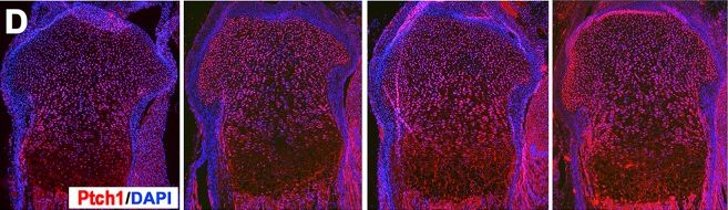 Patched 1/PTCH Antibody - BSA Free