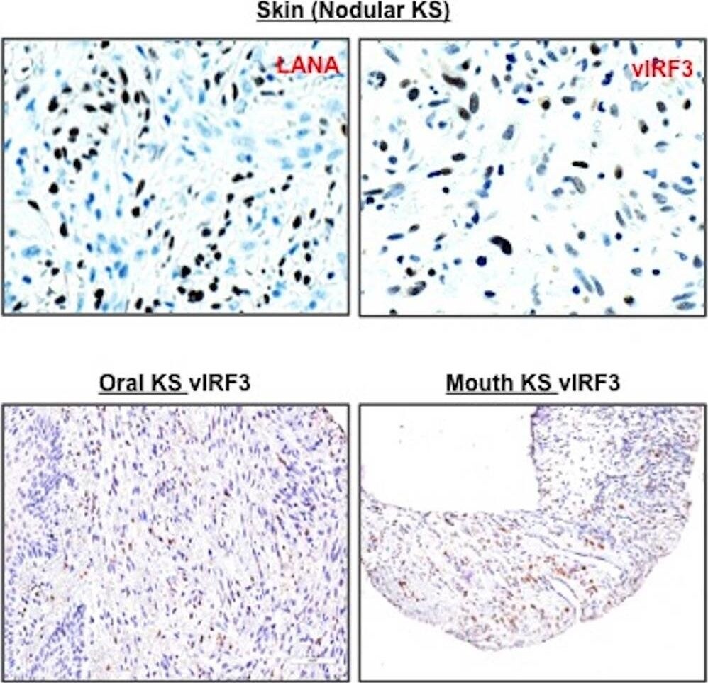 LANA2 Antibody (CM-A807) - BSA Free