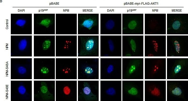 p19ARF/CDKN2A Antibody (5-C3-1) - BSA Free