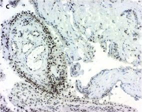 15-PGDH/HPGD Antibody