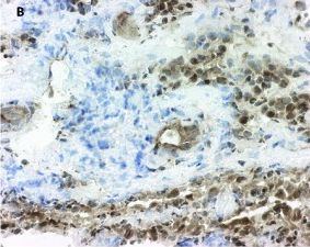 15-PGDH/HPGD Antibody