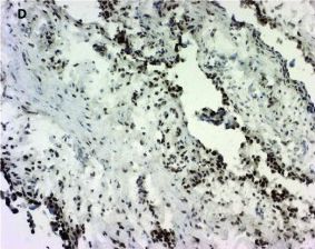 15-PGDH/HPGD Antibody
