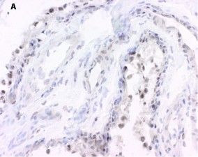 15-PGDH/HPGD Antibody