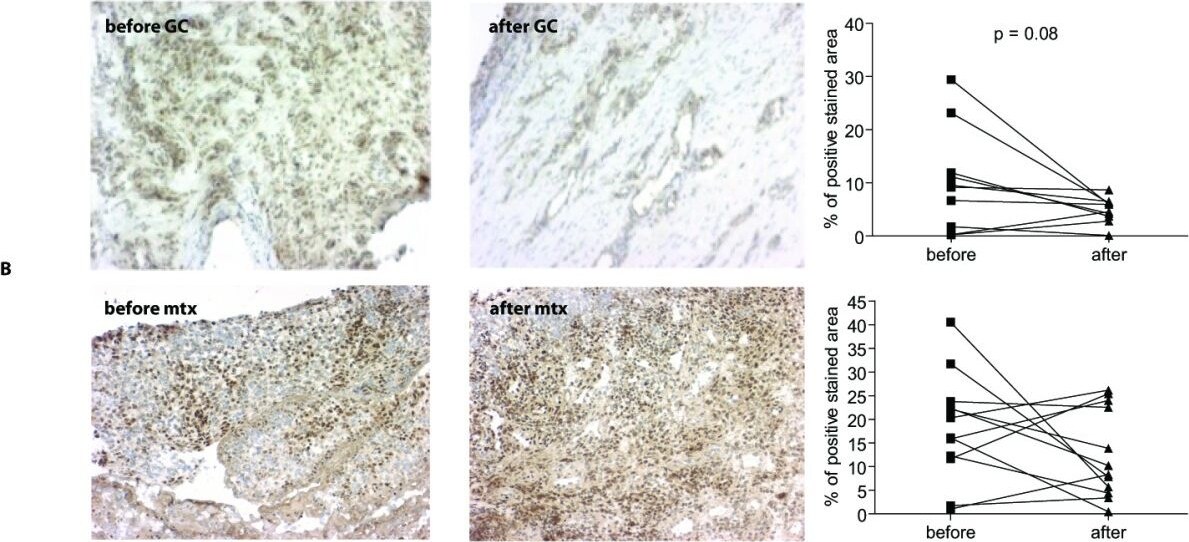 15-PGDH/HPGD Antibody