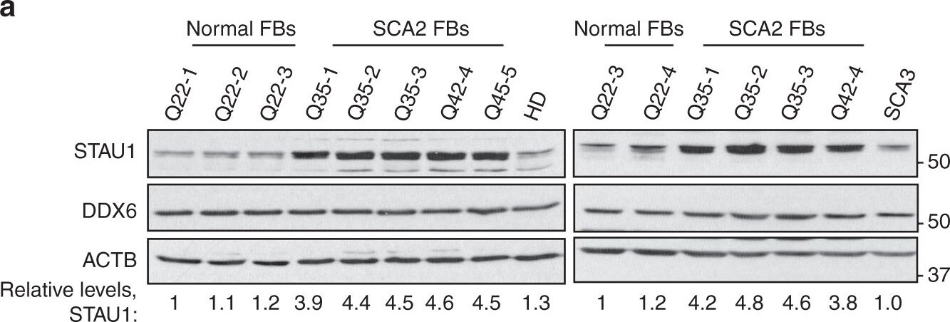 DDX6 Antibody