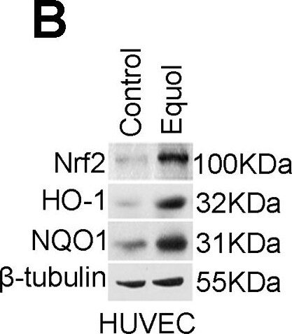 NQO-1 Antibody (A180)