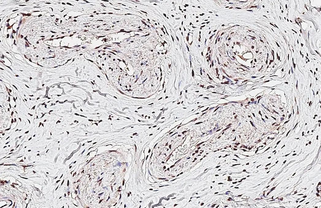 FoxO1/FKHR Antibody (7H3) - Azide and BSA Free