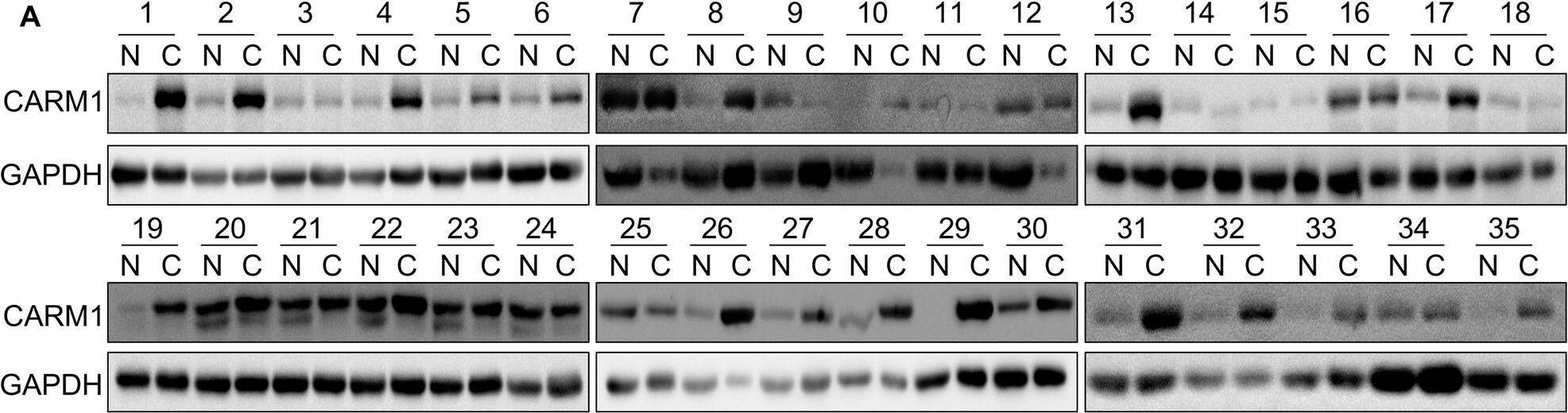 Carm1 Antibody - BSA Free