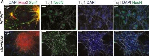 Synapsin I Antibody