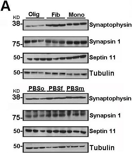 Synapsin I Antibody
