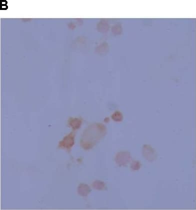 Tyrosine Hydroxylase Antibody