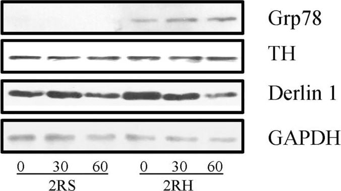 Tyrosine Hydroxylase Antibody