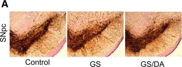 Tyrosine Hydroxylase Antibody