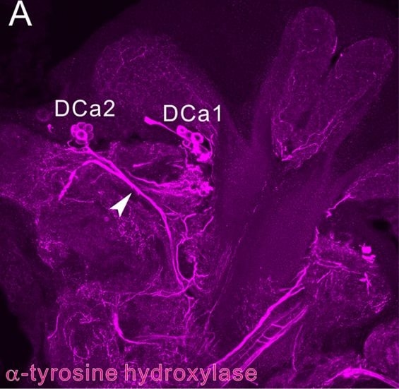 Tyrosine Hydroxylase Antibody