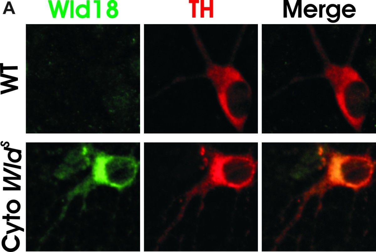 Tyrosine Hydroxylase Antibody