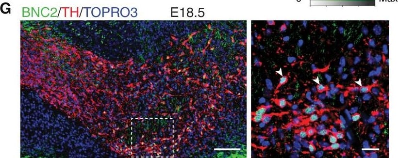 Tyrosine Hydroxylase Antibody
